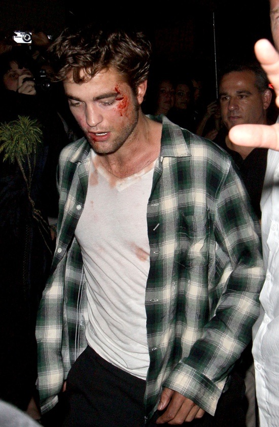 Robert Pattinson Bloody on Remember Me Set